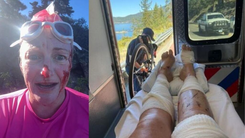 Reno Swimmer Attacked by River Otter in Lake Tahoe, Suffers 38 Stitches Reno Swimmer Attacked by River Otter in Lake Tahoe, Suffers 38 Stitches