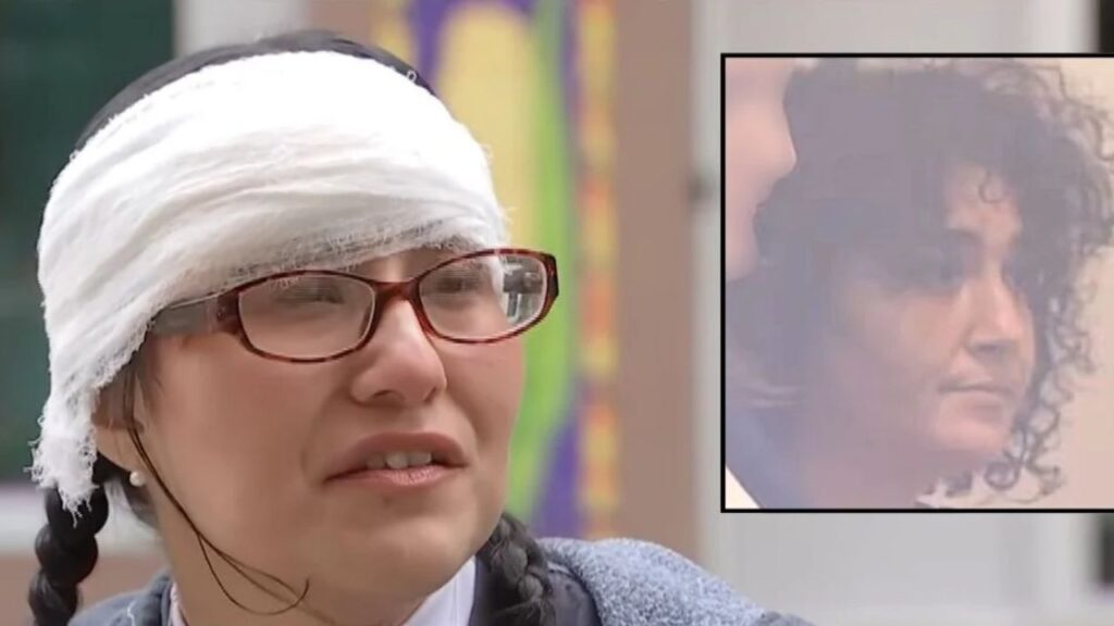 Seattle Woman Attacked and Bitten on Forehead While Walking to 7-Eleven Seattle Woman Attacked and Bitten on Forehead While Walking to 7-Eleven