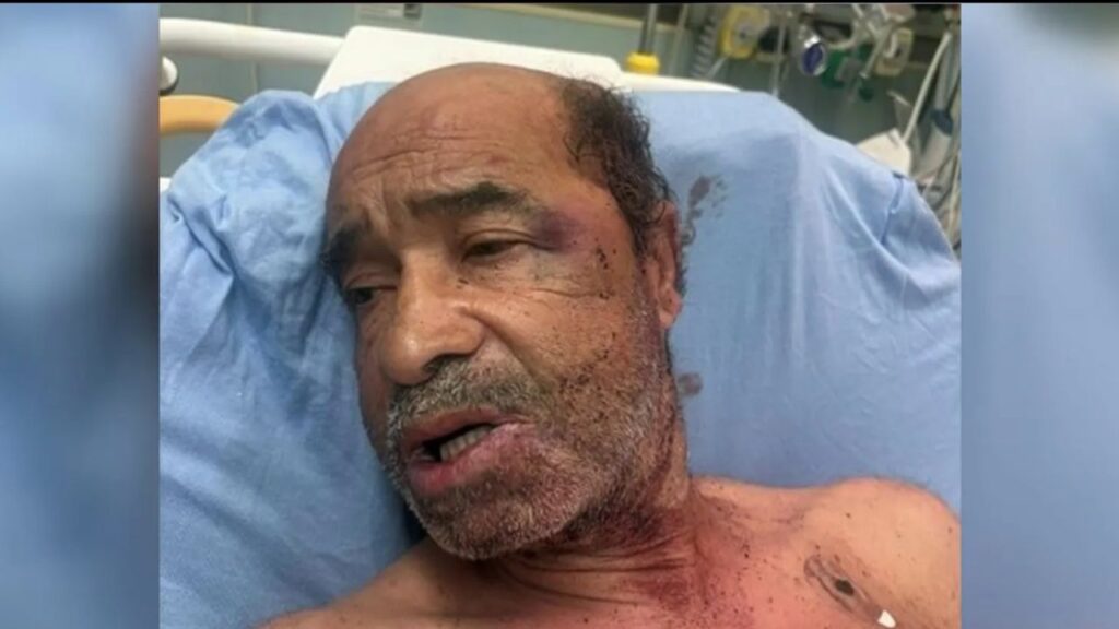 Retired Teacher Attacked and Robbed by Six Men in Broad Daylight in Hollywood Retired Teacher Attacked and Robbed by Six Men in Broad Daylight in Hollywood